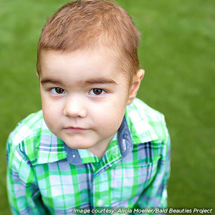 Professional 3_use credit Alicia Moeller_Bald Beauties Project